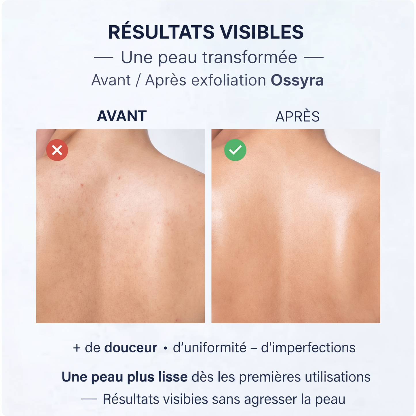 Serviette Exfoliante Ossyra