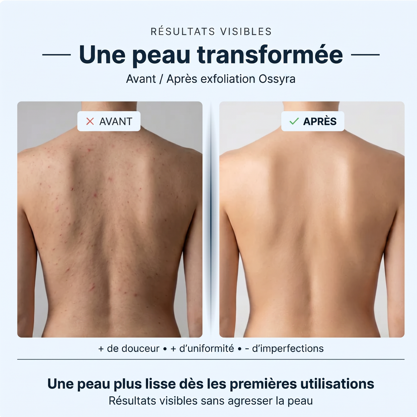 Serviette Exfoliante Ossyra